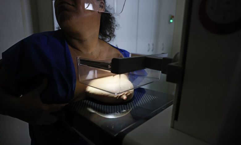 Mamografia digital em exame de diagnóstico de câncer de mama