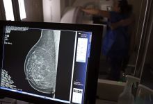 Mamografia digital passa a ter cobertura obrigatória pelos planos de saúde para todas as pessoas
