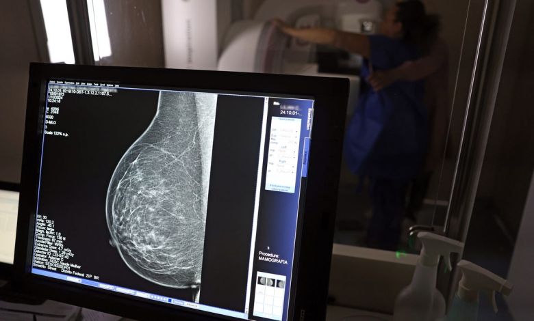 Mamografia digital passa a ter cobertura obrigatória pelos planos de saúde para todas as pessoas